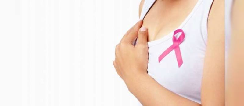 Tarama mamografisi